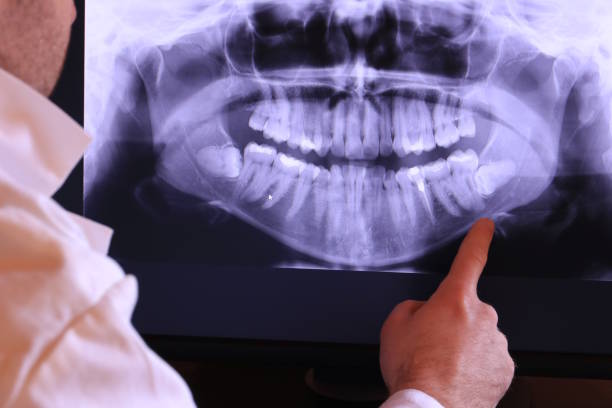 Best Emergency Treatment for Oral Infections in Navassa, NC