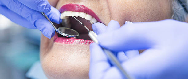 Best Emergency Wisdom Tooth Extraction in Navassa, NC